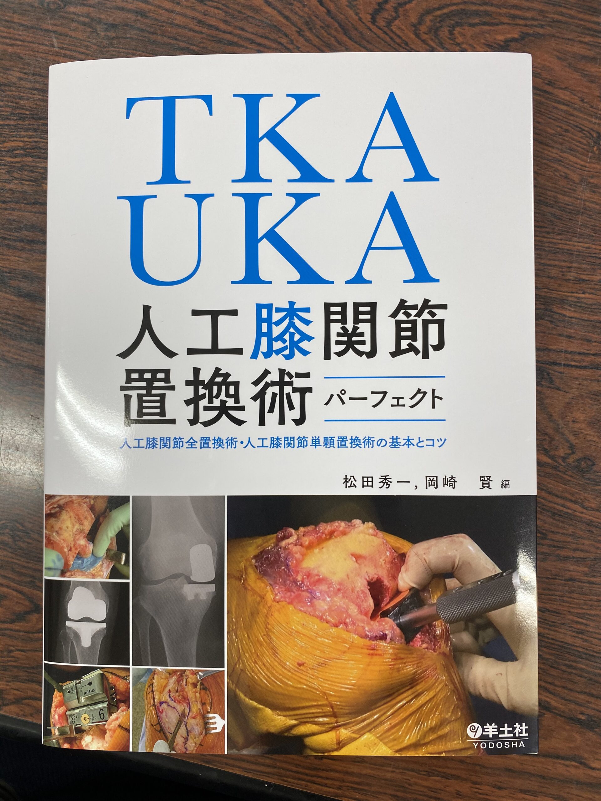 TKA・UKA 人工膝関節置換術パーフェクト-